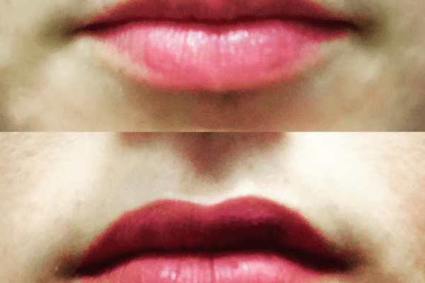 lip14